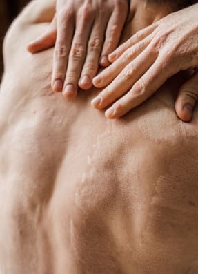 Laser vs Surgical Scar Removal